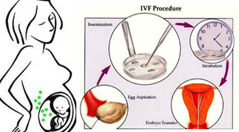 IVF procedure Kenya