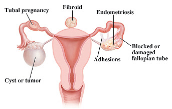 Reproductive surgery in Kenya